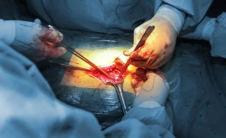 Open Surgery