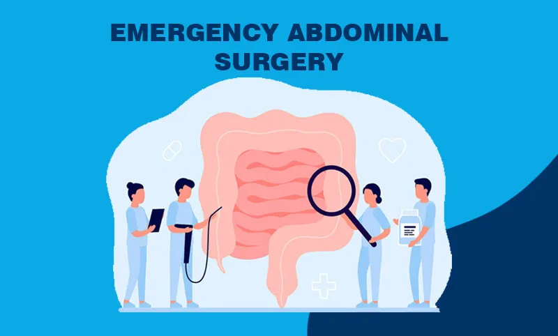 EMERGENCY ABDOMINAL SURGERY